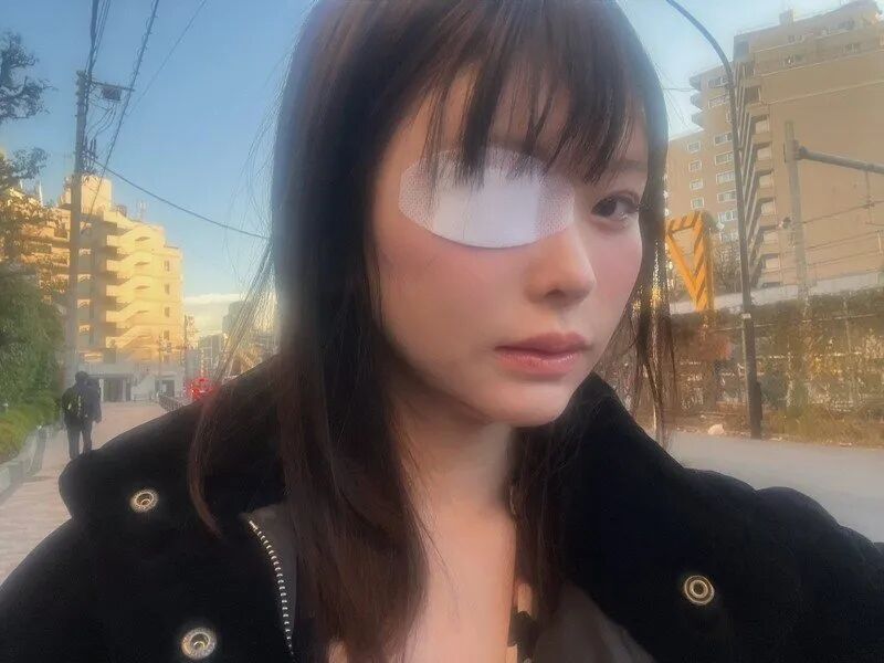 改回本名的明日见未来被前男友打到受伤。图撷取自X